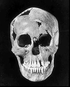 The Minnesota Woman skull